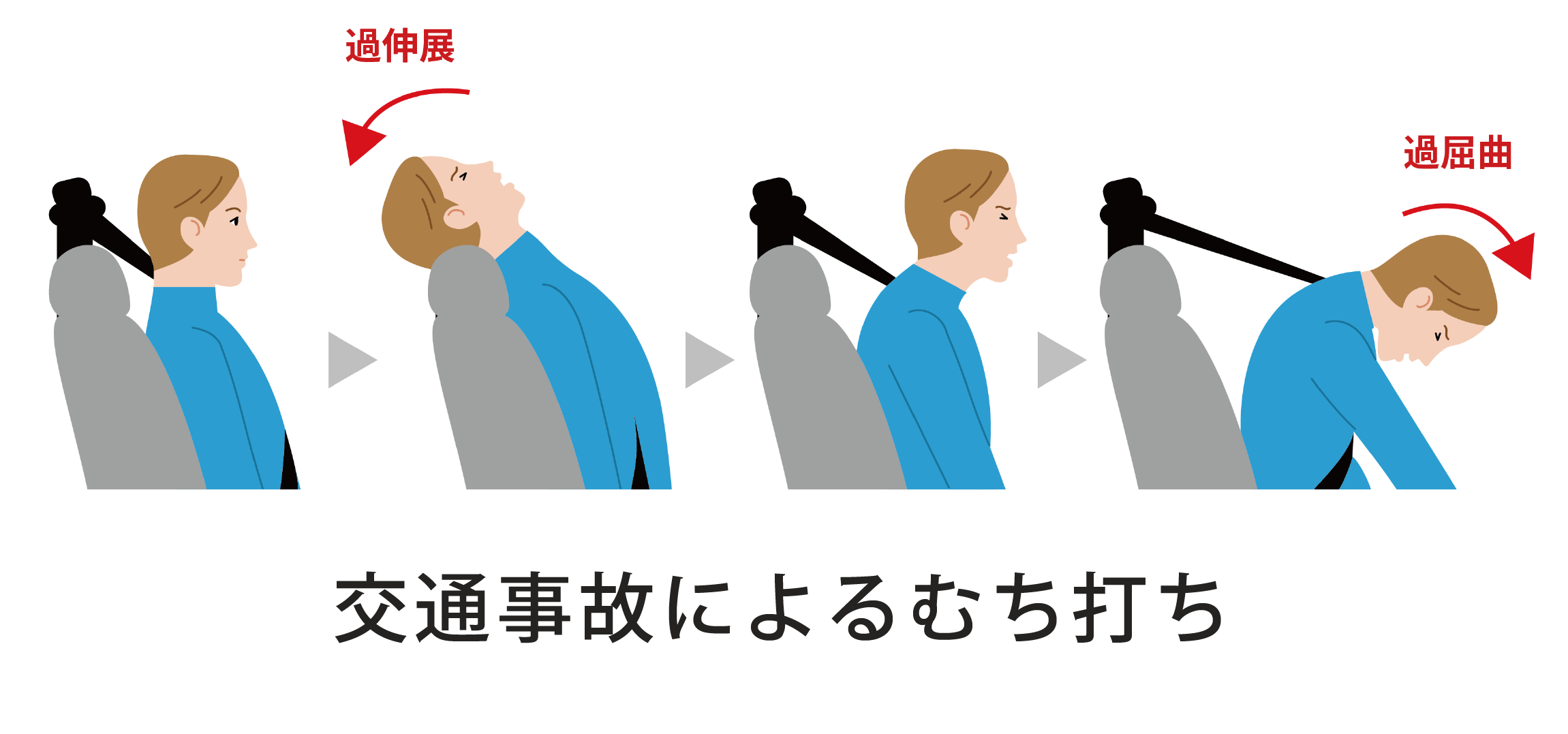 首のむちうちの治し方 ｜必ず押さえておきたい対処法をポイント解説！ - 株式会社リハサク
