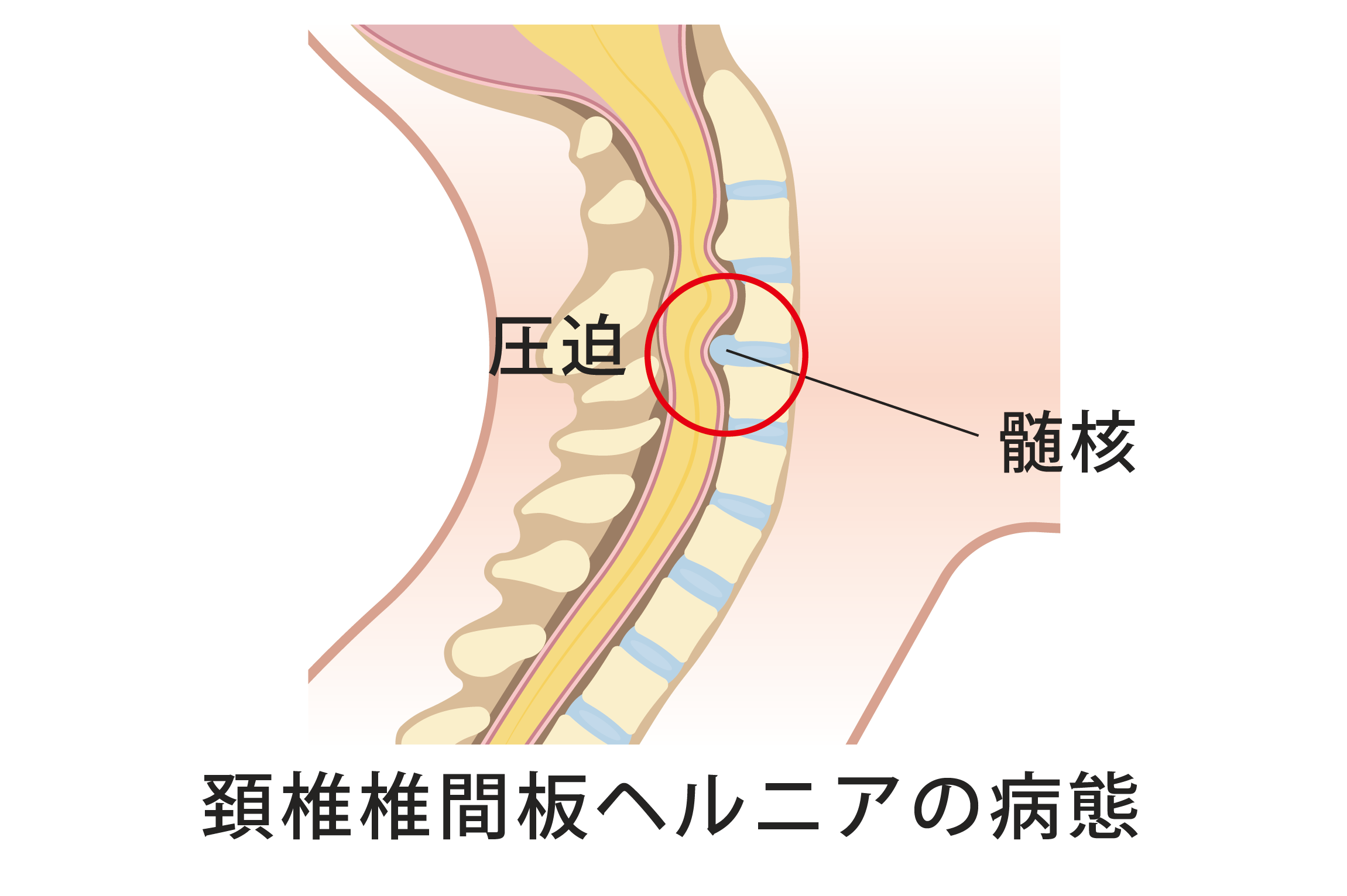 頚椎症で効果があるストレッチ&してはいけないことを解説 - 株式会社