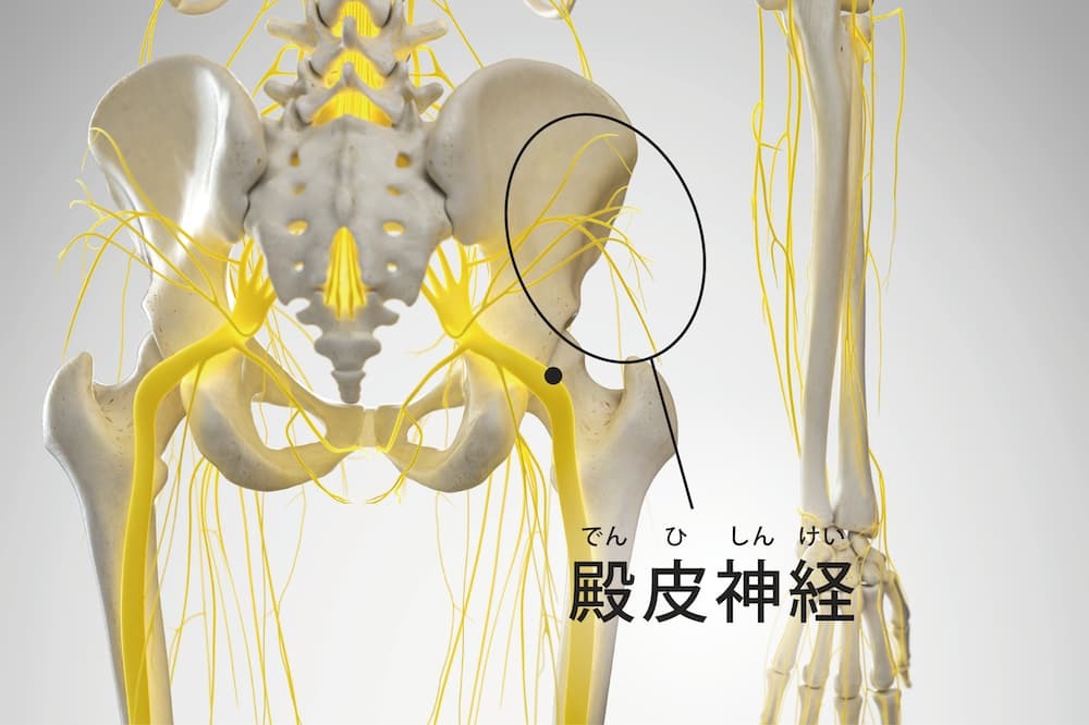 腰痛 神経痛 などに 坐骨神経痛でお悩みの方へ！ | エムズ整骨院 志木本町院