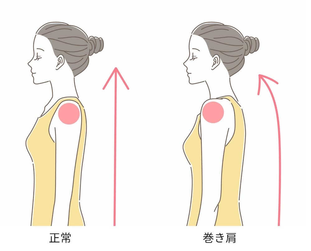 巻き肩を治す方法はある?効果的な寝方やグッズの使い方・おすすめストレッチを解説 - 株式会社リハサク