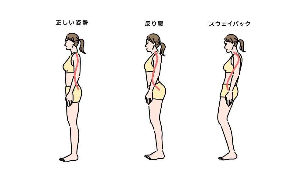 内反膝（O脚）とは？原因と治し方をシンプルに解説 - 株式会社リハサク