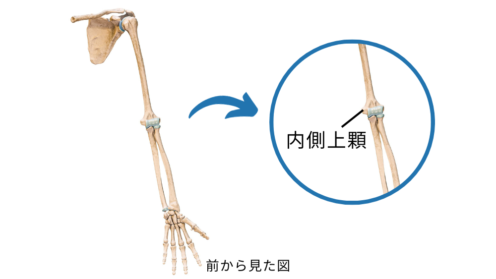 どめ（右腕が麻痺してます） 橈骨神経麻痺（とうこつしんけいまひ）Radical Nerve Palsy
